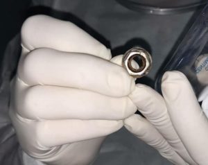 ¡Niña de 5 años jugó al mecánico y tragó una feroz tuerca!