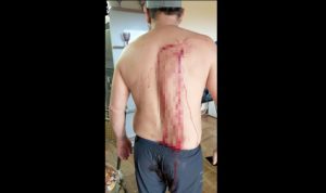 “Pierna peluda” habría embarazado a empleada y “catedral” le reventó la espalda con vaso de vidrio