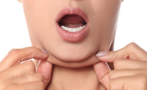 Papadas son producto de abusar con lelu, según estudio