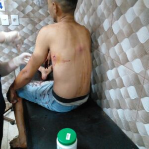 Joven fue atacado a balazos en Hernandarias