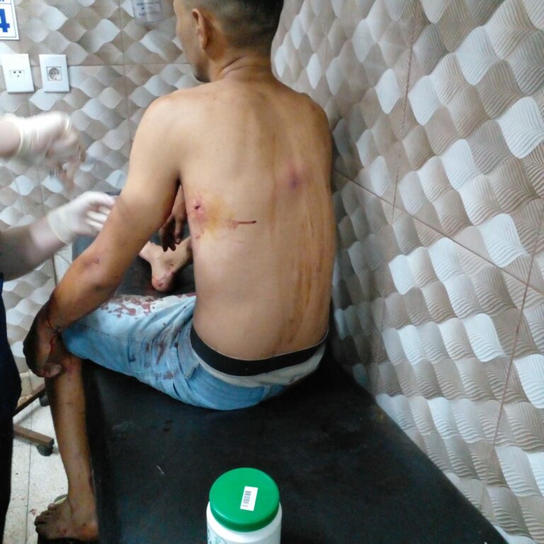 Joven fue atacado a balazos en Hernandarias