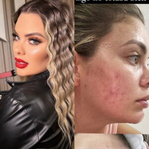 Top muestra cómo estaba su rostro tras ponerse en forma