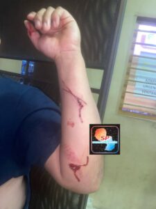 Roce vehicular terminó en acuchilladas