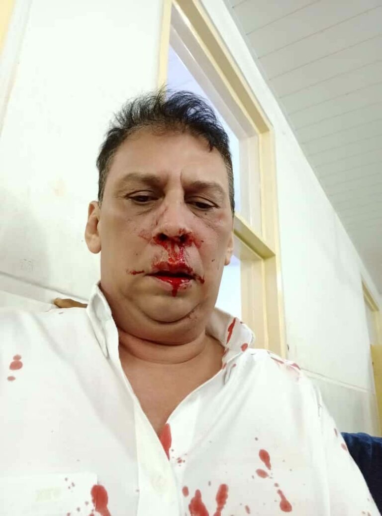 ¿Periodista fue agredido por orden de un senador hovy?