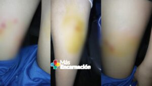 Perros sueltos atacan a estudiantes en Encarnación