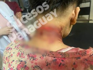 Menor herido con cuchillo en presunto intento de feminicidio