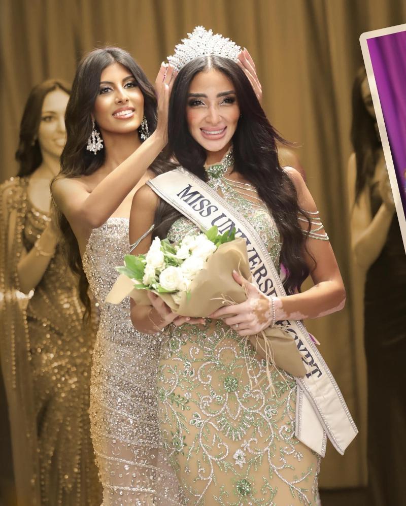 Popular / ¡Miss Egipto, es la primera mujer con vitíligo que concursará