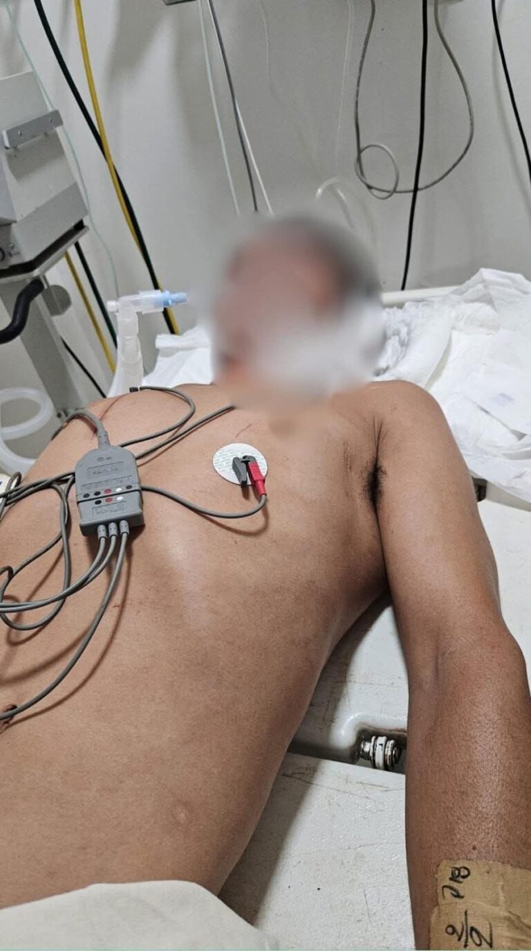 Juego mortal: murió hombre que recibió un botellazo por deuda de truco