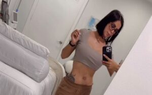 Jessica Sly mostró el proceso de recuperación de su cintura que había quedado deforme