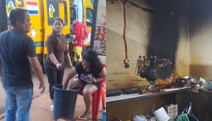 Mujer sufrió quemaduras tras intentar apagar incendio de freidora