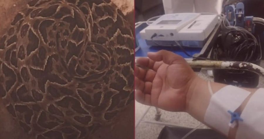 Rescate de bomberos a yarará terminó en sarambí: Uno fue mordido y le traspasó los colmillos