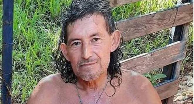 Autopsia reveló que karai muerto por ataque de pitbull tuvo una muerte agónica anga