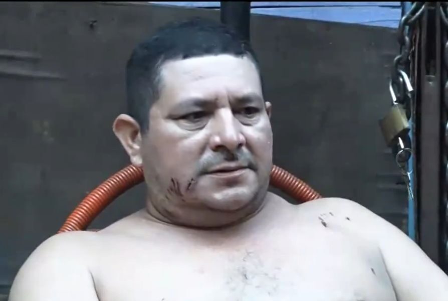 Sale de alta víctima sobreviviente de ataque de pitbull