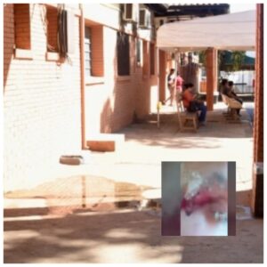 Denuncian que médicos pegaron ojo de un niño con la “gotita” en lugar de la herida