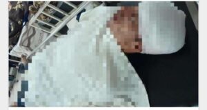 Joven recibió puñalada en la cabeza y está grave