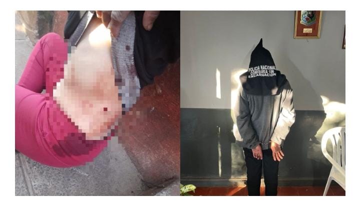 Doña quedó detenida upéi de acuchillar a su vecina