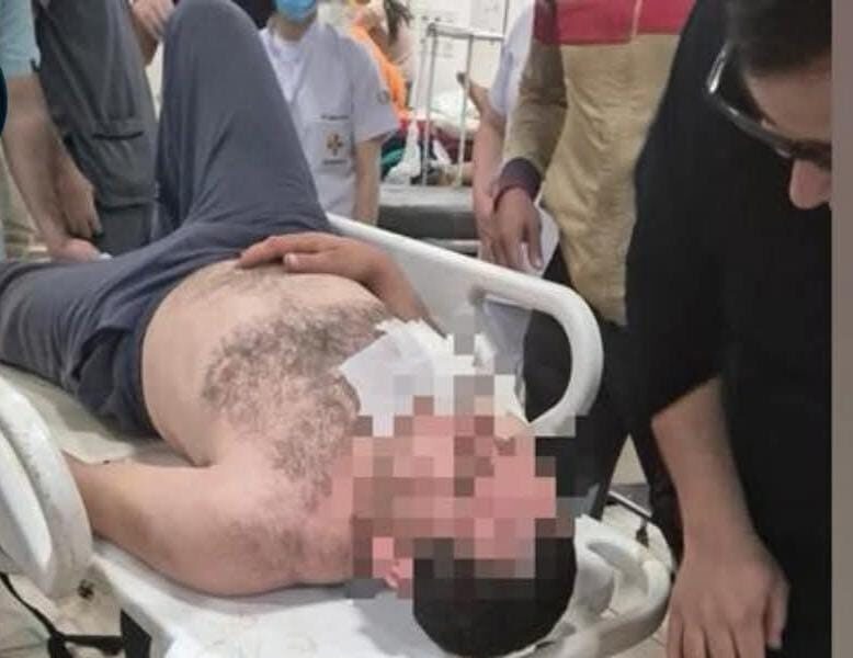 En medio de partido de vóley hombre recibió una puñalada