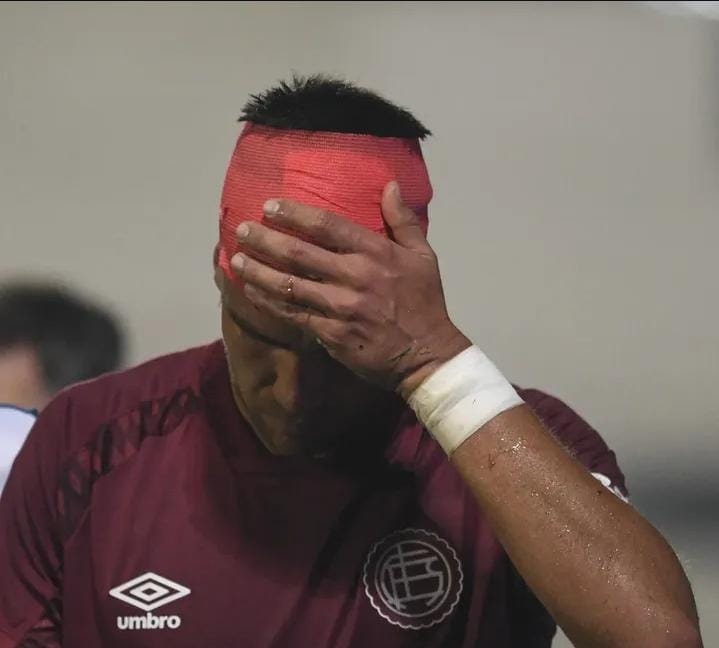Pelotero paraguayo sufrió fractura de cráneo en pleno partido: “Está evolucionando”