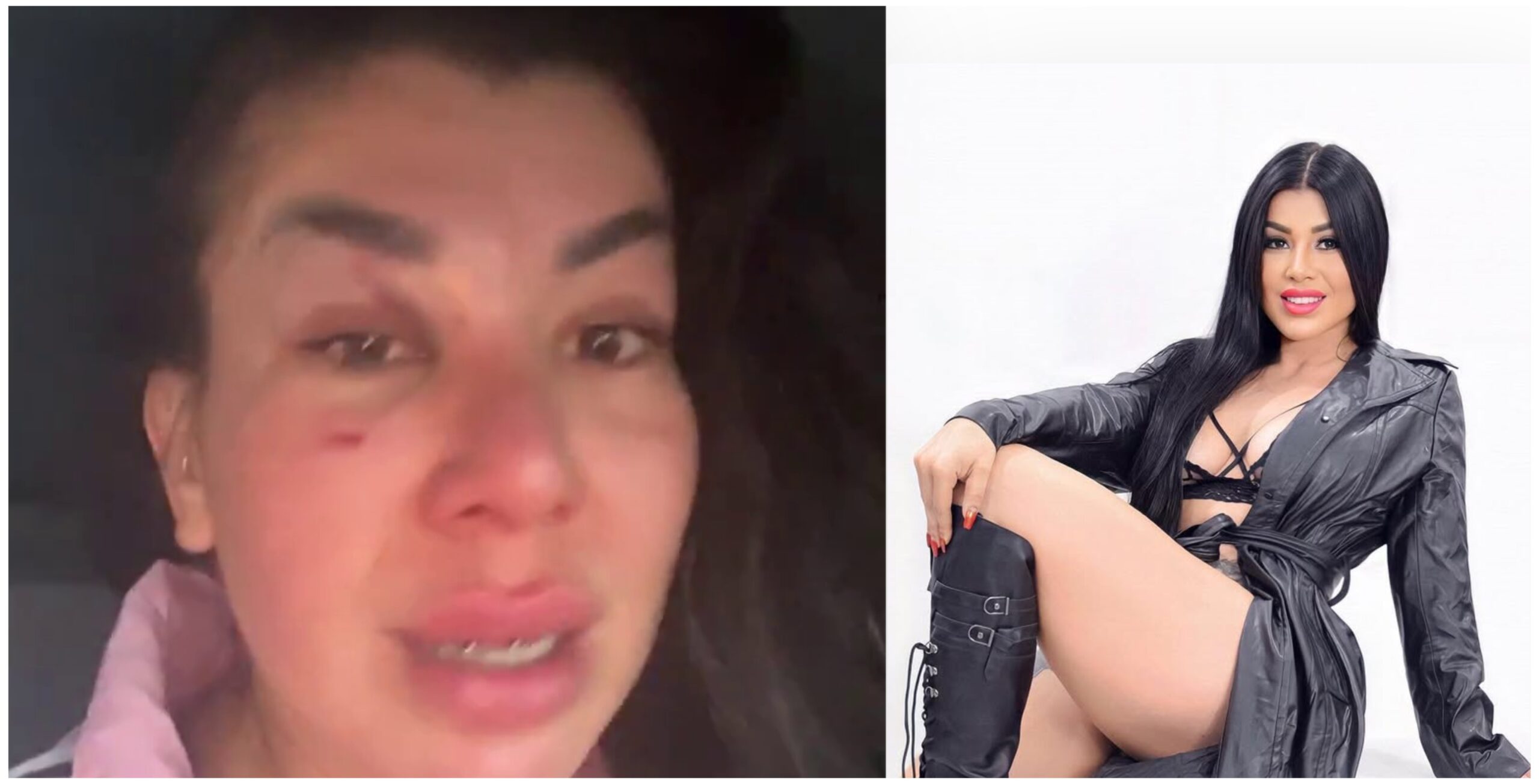 (VIDEO) ¡Modelo quedó desfigurada por querer salvar a un gatito!