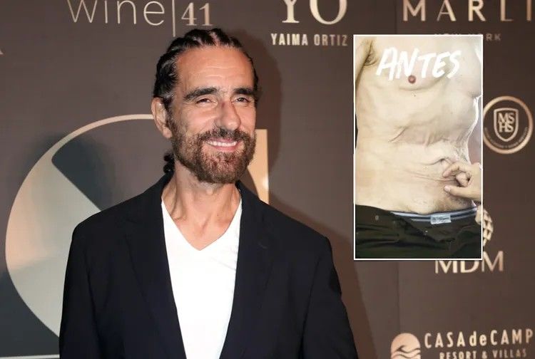 ¡Actor de “Pedro el escamoso” muestra el antes y después de su nuevo tuneado!