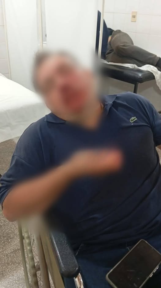 ¡Hesúkena! Casi le borran la cara a capeto de una Aso de Cañicultores de Guairá