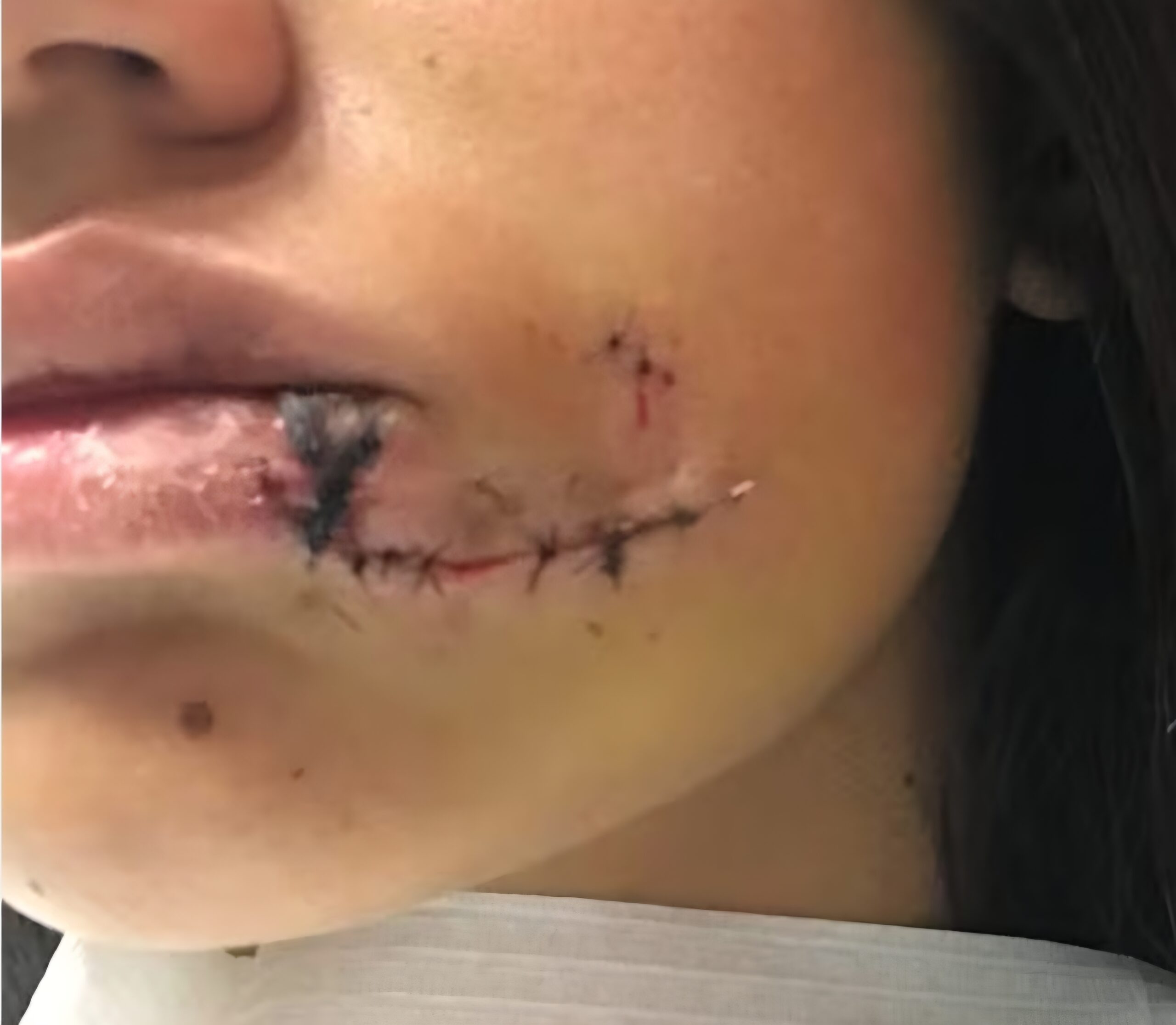 Militar celoso oisu’u a su yiyi hovápe