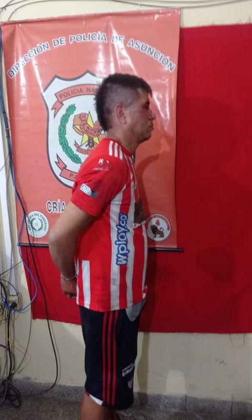 Imputan a colombiano por jejuka de su hijastro en la Chaca