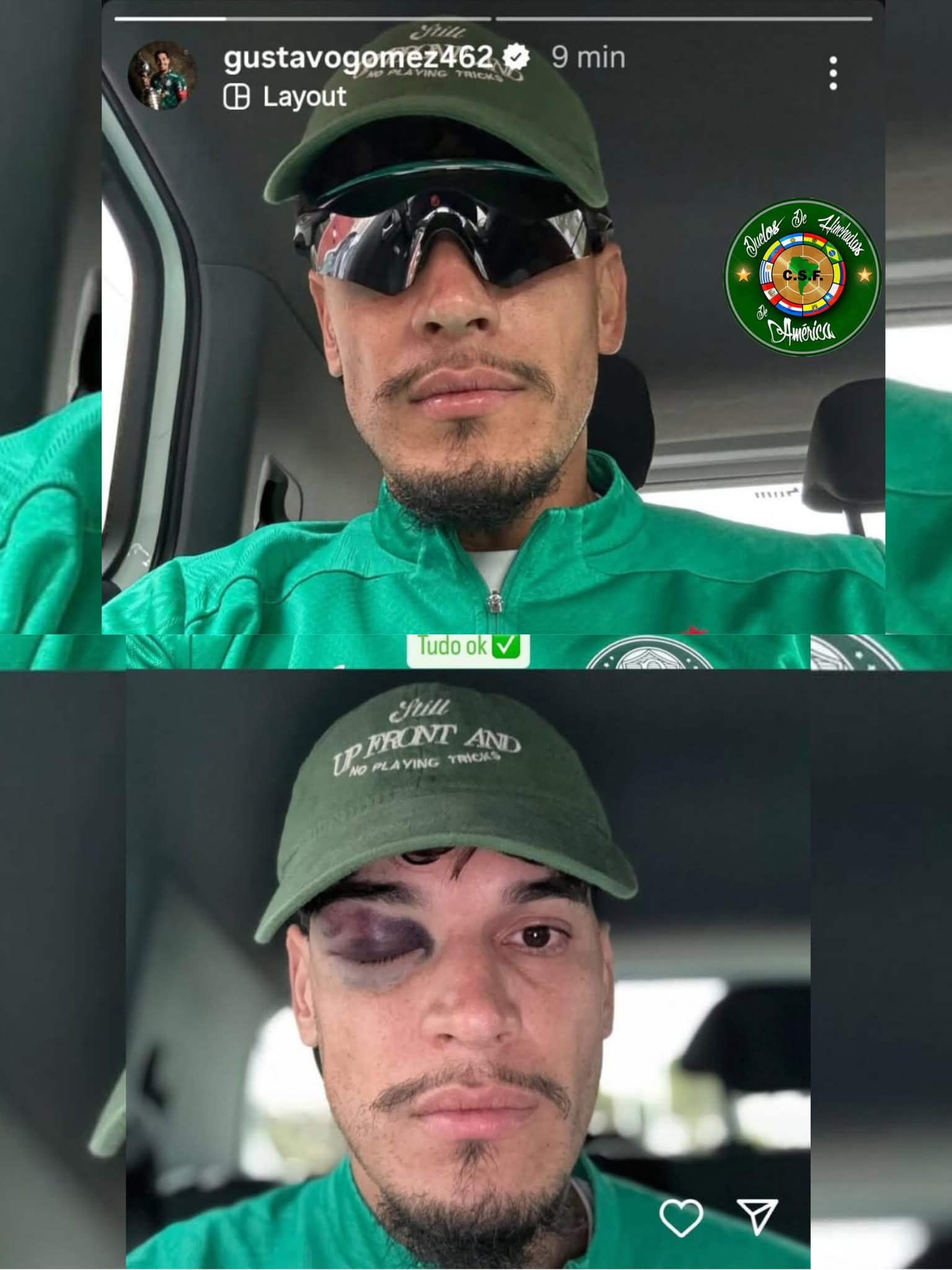 ¡Ndi bárbaro! El pelotero guaraní Gustavo Gómez mostró como le quedó el ojo anga