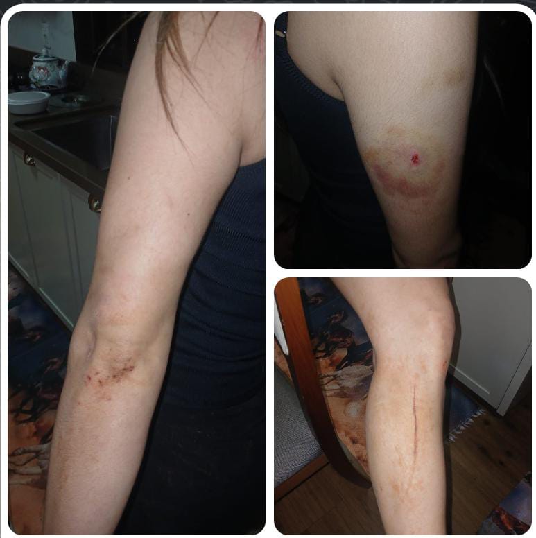 ¡Imputan hapóre a violento rapái que surtió a golpes a la esposa de su primo