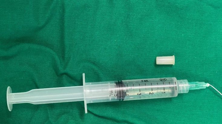 Una criatura de 3 años omokomi un silbato:”Se convirtió en una trompeta”