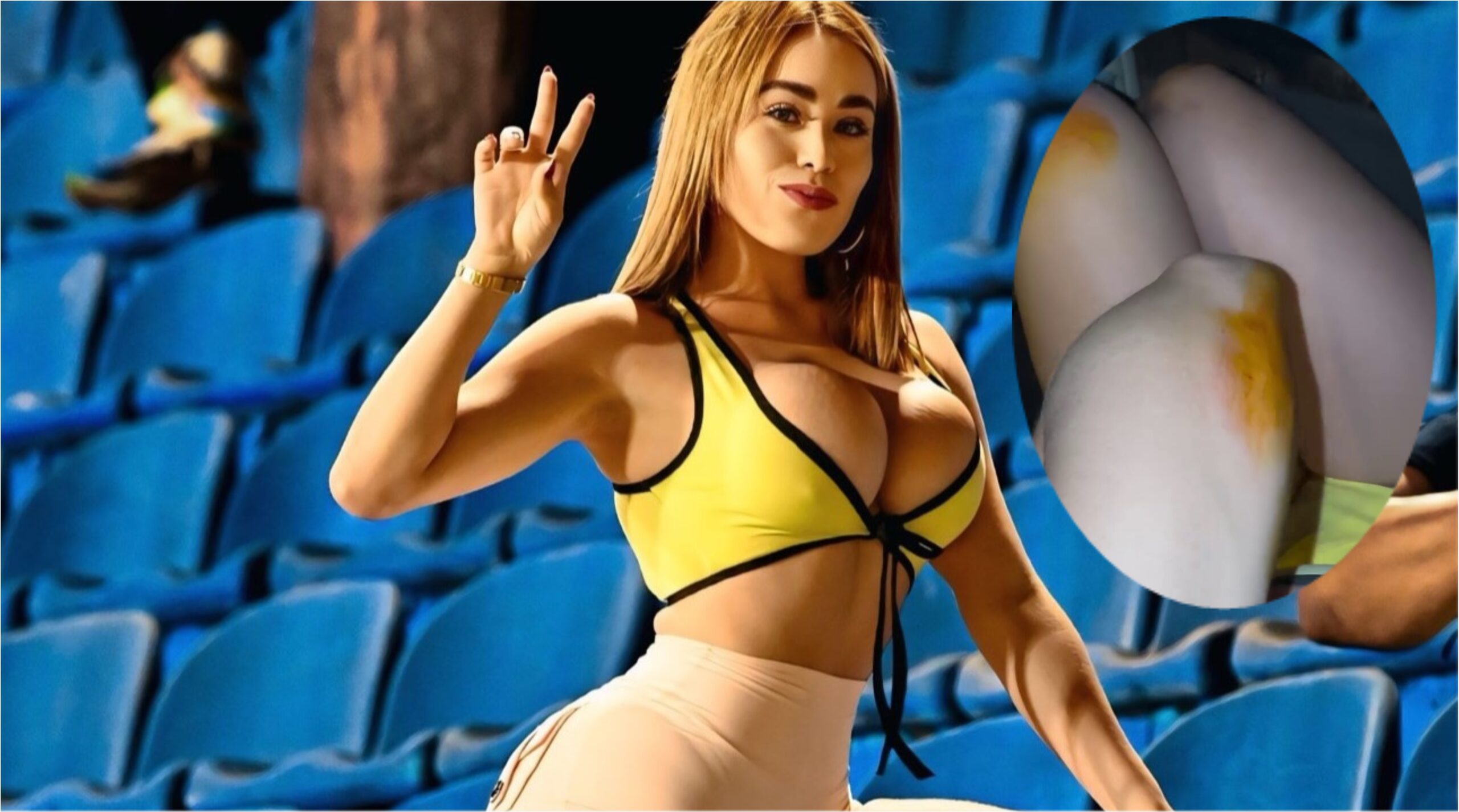 (VIDEO) ¿Qué le pasó? Maína de Guaraní quedó toda machucada luego del partido contra Libertad