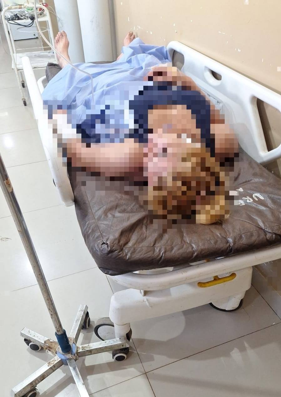 Villarrica: Doña atacó a un poli por evitar su autoflagelo