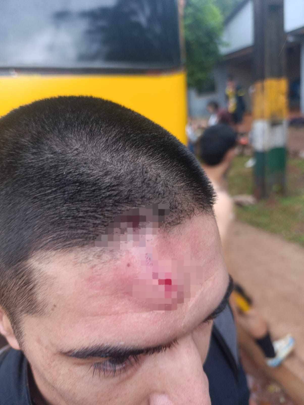 En violento ataque contra micro hincha isyvajeka