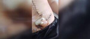 Familiares denuncian presunta negligencia en el Hospital Nacional y piden intervención de Salud para traslado