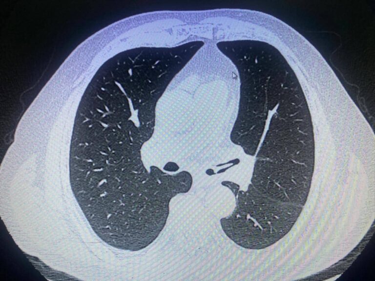 Policía detiene a peligroso delincuente miembro de banda criminal en Villarrica