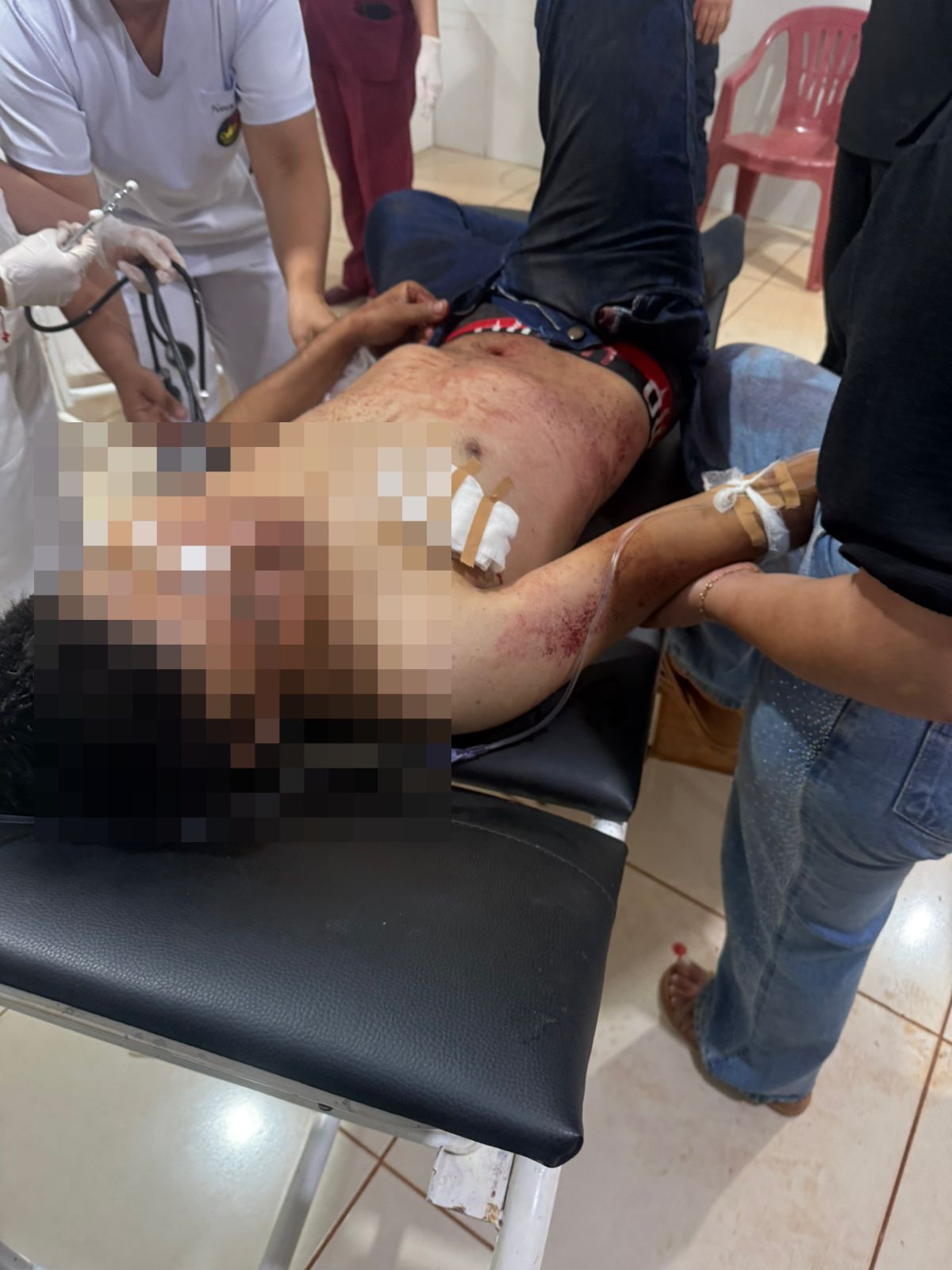 Dos hombres quedaron heridos durante una riña en Corpus Christi