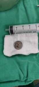 Mitakuña’i tragó una moneda de 100 y se salvó de milagro