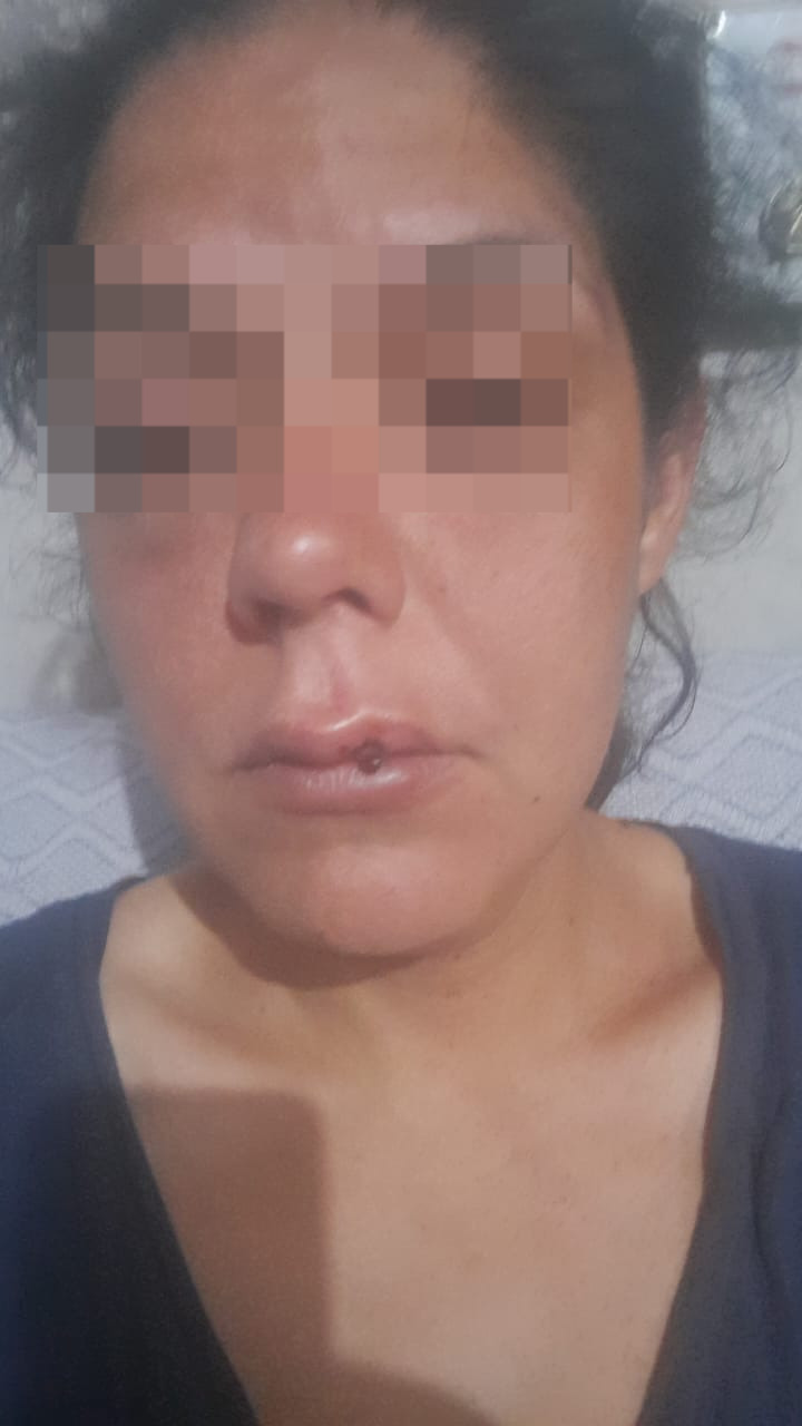 Mujer brutalmente golpeada por su pareja clama por justicia