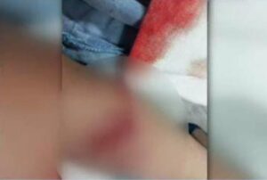 Nene fue mordido por un ka’i argel en su jyva