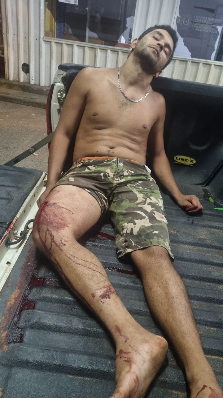 Joven ligó plomo y quedó hospitalizado