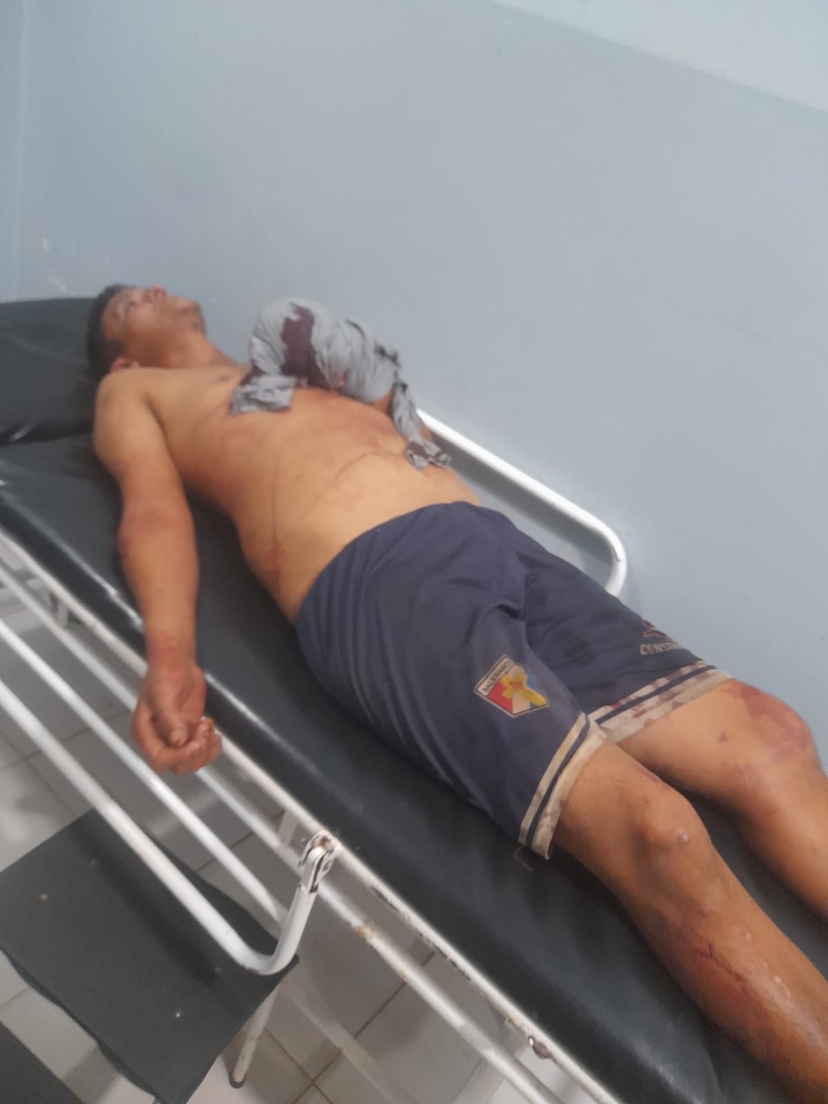 Casi opyta sin po, por ka’ucho