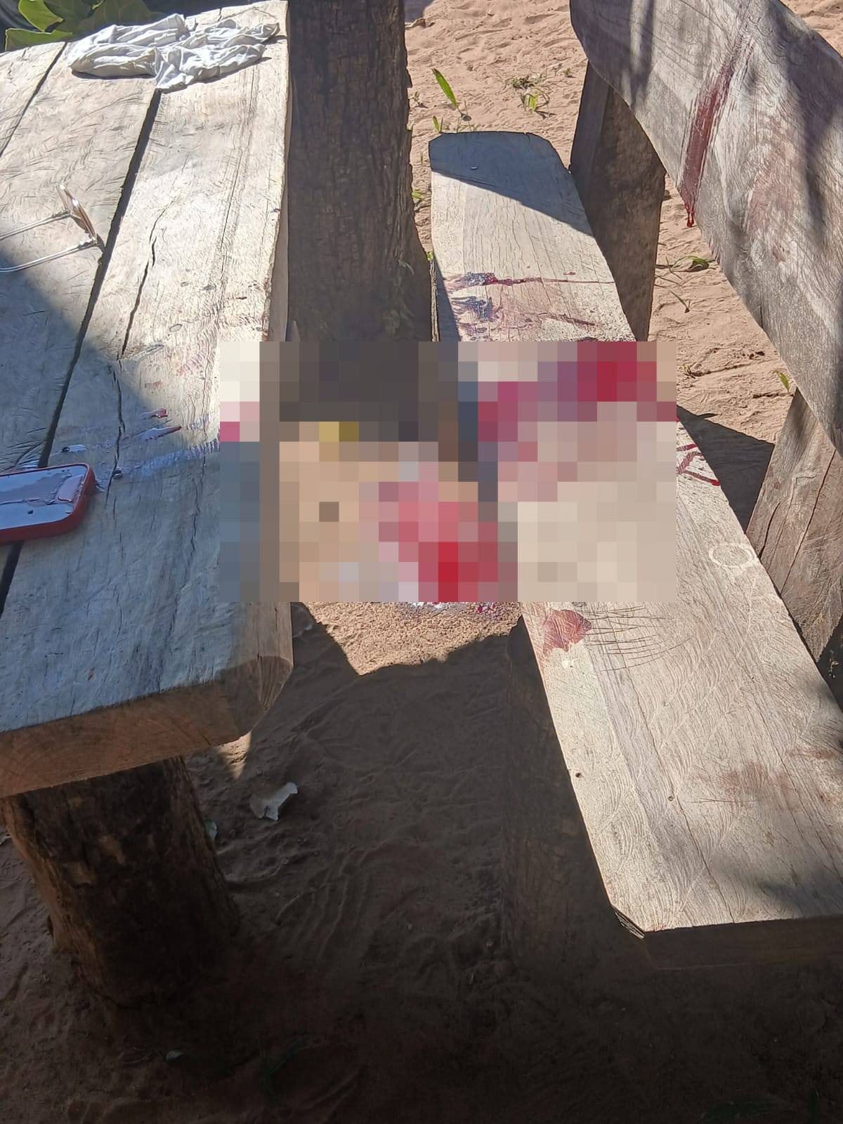 Milico quedó mal herido tras dispararse “sin querer”