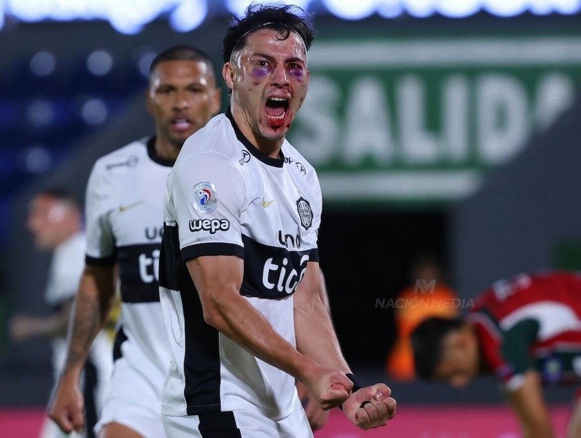 (GALERÍA) El gol más ingueroviable ya tiene memes: “El verdadero caradura fui”