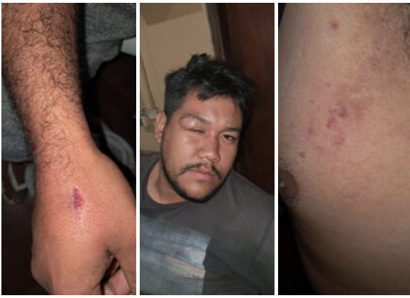 “Drácula” atacó a machetazos, itá y colmillazos a sus sobrinos