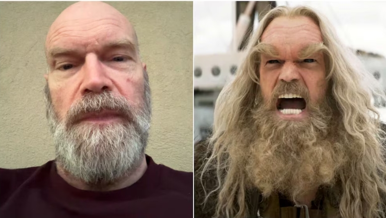 ¡Actor de X-Men contó que padece cáncer de mama!