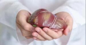 Salud presentó guía pyahu para hepatitis B Salud presentó guía pyahu para hepatitis B